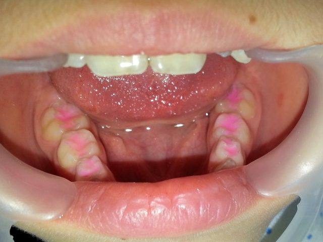 sigilari dentare